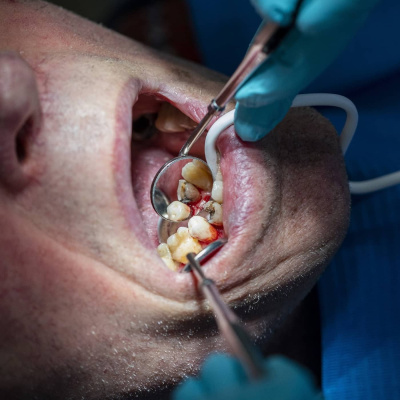 Radio Sweden Somali - Raadiyaha Iswiidhen