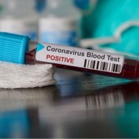 NutriMedical Report Fri Feb 14th ’20 Hr1 SARS PainAway SuperFolateTR+