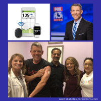 Eversense: The Implantable CGM