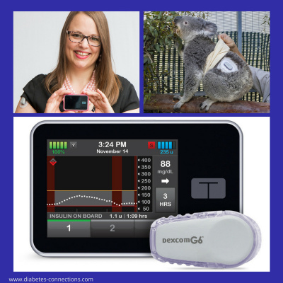 Diabetes Connections With Stacey Simms | Type 1 Diabetes |