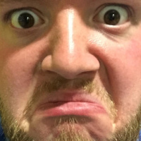 #BoomJune Day 9 - The funny thing about sunburn