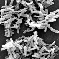 PODCAST: Neediness, episode 1