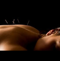 Acupuncture