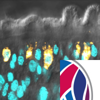 Spotlight on tropical diseases