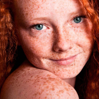 ¿Cuál es la diferencia entre las pecas o los lunares?