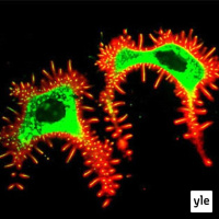 Syöpä mikroskoopissa (S)