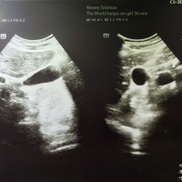 Alexei Smirnov – The World keeps on girl 56 mix