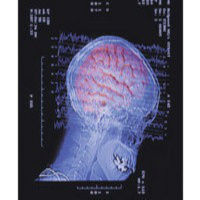 Laboratorio de Ideas - Fase REM