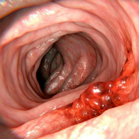 Whos Right Rectal Examination of Laura Owes Us A Flag Ft Special Guest Back-Up Black Guy Delvin Cox