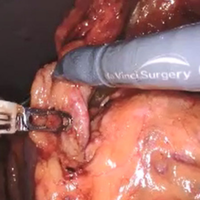 Jama Surgery Author Interviews: Covering Research, Science,  Clinical Practice In Surgery To Assist Surgeons In Optimizing P