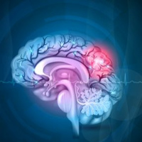 Episode 91 - A Remarkable Trial - Sharon and the treatment that changed her