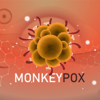 Should you be concerned about Monkeypox?