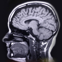 Jag är hjärnforskare