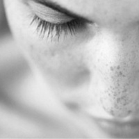 005 Manchas en la piel ¿son todas iguales?