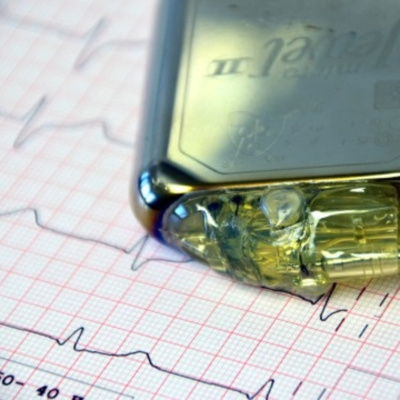 Milanga Electrónica