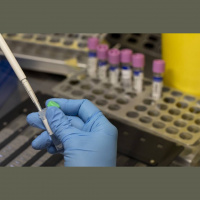 LA County Ramping Up Its Distribution Of Monkeypox Vaccines