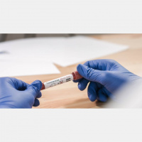 State Recommends Weekly COVID-19 Testing for Health Care Workers