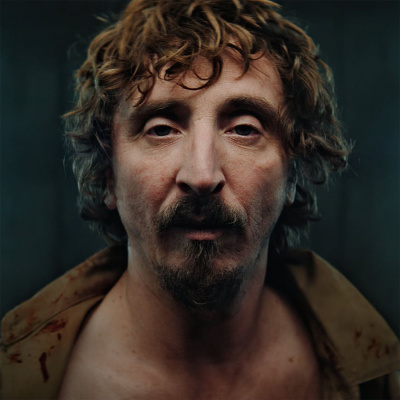 Quémese Después De Escuchar