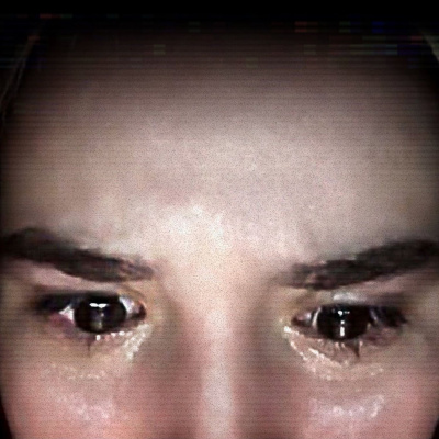 Quémese Después De Escuchar