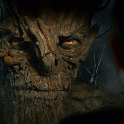 Quémese Después De Escuchar