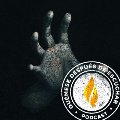 Quémese Después De Escuchar