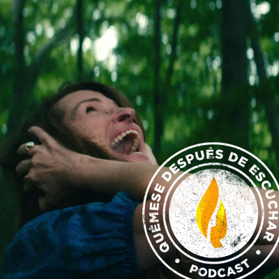 Quémese Después De Escuchar