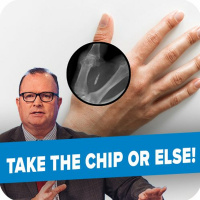 Dont let this get under your skin | Open Line Friday