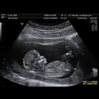 40 - Ultrasonidos, Sistemas de Datos... Y Jamie Ramsey