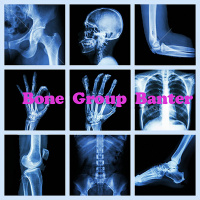 2019-E2: The effects of physical activity on your bones during adulthood and ageing