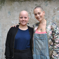 Sara om att leva utan hår