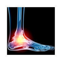 Chronic Foot Pain with Dr. Roy Mathews DPM