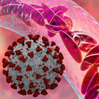 Episode #76 - Sickle Cell Disease/COVID - 19 International Registry