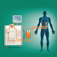 Episode #52 - HIPEC: Advancement in Treating Stage-4 Abdominal Cancers