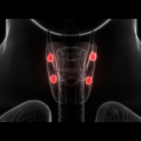 Episode #131 - Hyperparathyroidism