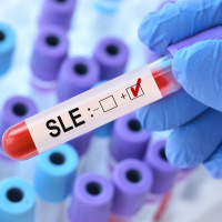 Episode #125 - Lupus: Breakthrough Discovery  Diagnostic Challenges