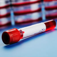 Episode #49 - Blood Research: Diagnosing HIT