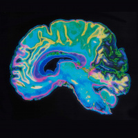 Episode #23 - Connectomes  Genomes