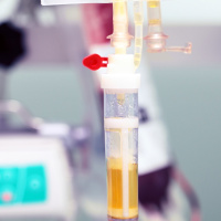 Episode #82 - CONTAIN COVID Convalescent Plasma Clinical Trial