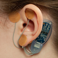 Episode #86 - Auricular Neurostimulation: Therapy for Functional Abdominal Pain Disorders