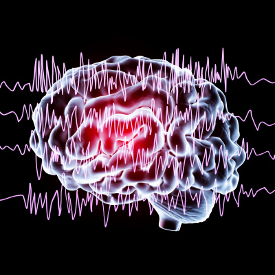 Ctsi Discovery Radio