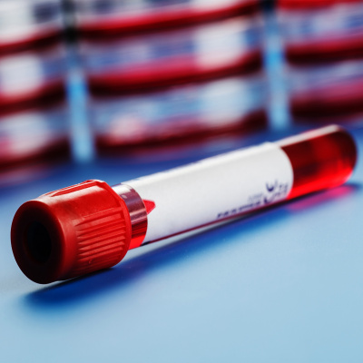 Ctsi Discovery Radio