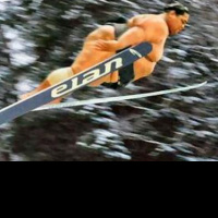 Episode 31: Flakey scalp and spitting chicken