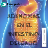 Adenomas en el Intestino delgado