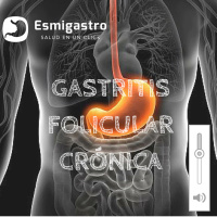 Gastritis Folicular Crónica
