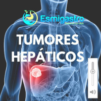 Tumores Hepáticos