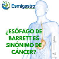 ¿Esófago de Barrett puede ser causa de cáncer?