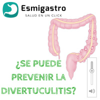 ¿Se puede prevenir la divertuculitis?