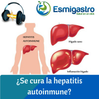 ¿Se cura la hepatitis autoinmune?