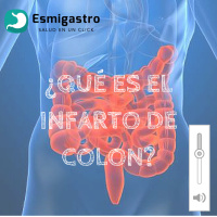 ¿El colon se puede infartar?