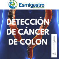 Detección de Cáncer de Colon
